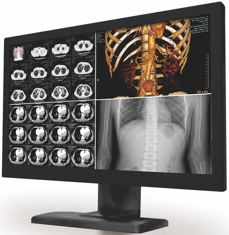 KD-C41 304Mɫ400